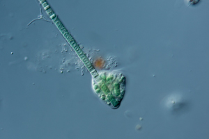 Amoeba feeding on cyanobacteria