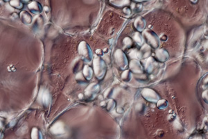 Zellen der Knolle mit Stärkekörnern