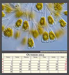 Licmophora spec Diatoms, North Sea, German Bight. Image width 0,3mm