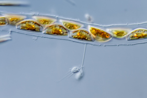 diatoms Cymbella