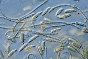 Anabena Cyanobakterien