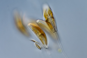 Diatoms Cymbella