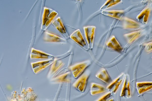 Diatoms Gomphonema