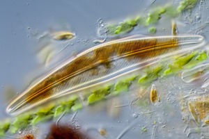 Diatoms Cymbella und Navicula