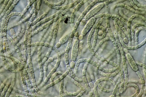 Cyanobakterien Anabena