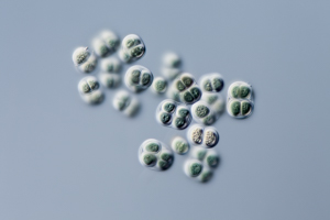 Cyanobakterien Chroococcus