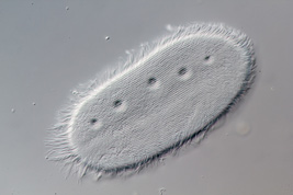 Anoplophrya sp., Macronucleus and contractile vacuoles