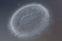 Anoplophrya sp., Focus into the cell