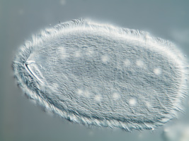 Metaradiophrya sp., hook apparatus and contractile vacuoles