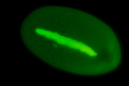 Metaradiophrya sp., Acridinorange, Fluorescence