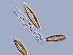 Navicula and diatom frustule with algal parasites