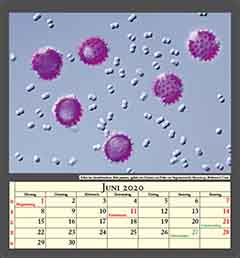 Pollen des Gänseblümchens, Bellis perennis, (gefärbt mit Fuchsin) und Pollen von Vergissmeinnicht, Myosotis sp., Bildbreite 0,17mm