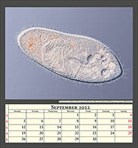 Paramecium caudatum with strong parasitisation of the macronucleus by Holospora sp., image width 0.2mm