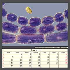 Staubfadenhaare von Tradescantia virginiana, mit Pollenkorn. Bildbreite 0,3mm