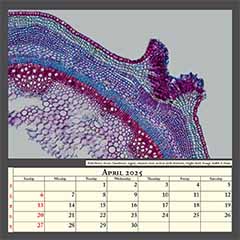 Elderberry shoot (Sambucus nigra), stained cross section with lenticels, bright field. Image width 0.5mm