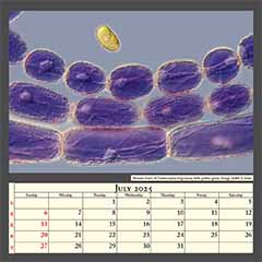 Stamen hairs of Tradescantia virginiana, with pollen grain. Image width 0.3mm