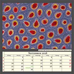 Blutregen-Alge Haematococcus pluvialis, Phasenkontrast, Bildbreite 0,2mm