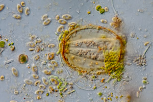 Platycola ciliates in lorica