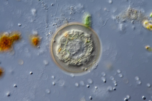 Arcella testste amoeba