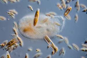 Chilodonella ciliate and diatoms