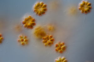 Synura golden algae